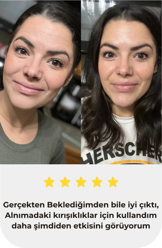 Roksellos™ Kolajen Bandı