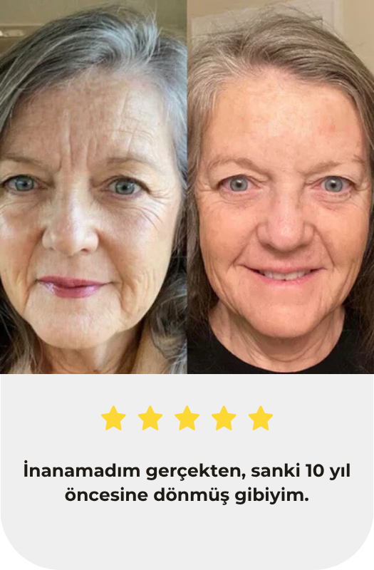 Roksellos™ Kolajen Bandı